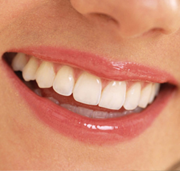 Low Cost Teeth Reshaping Recontouring Treatment South ...